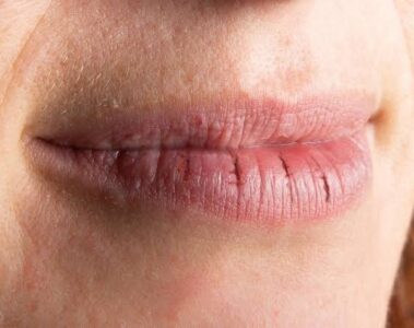 What Does Menopause Dry Mouth Feel Like