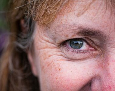 dry eyes menopause 1