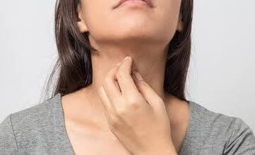 menopause itchy skin1 1