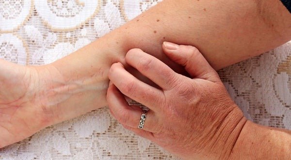 menopause itchy skin3 1